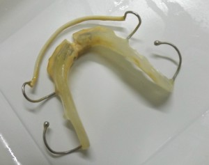 Placca ortodontica prima del trattamento Splendente